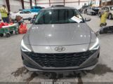 HYUNDAI ELANTRA LIMITED photo