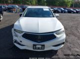 ACURA TLX TECH PKG photo