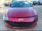 HYUNDAI ELANTRA SE photo