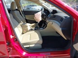 Acura Ilx Acurawatch Plus Package 19UDE2F35HA011616 снимка