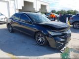 ACURA ILX PREMIUM PACKAGE/TECHNOLOGY PACKAGE photo