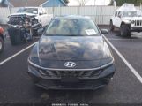 HYUNDAI ELANTRA LIMITED photo