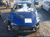 HYUNDAI ELANTRA SEL 5NPD84LF5LH584890 fotografie