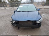HYUNDAI ELANTRA SEL 5NPD84LF6JH244970 fotografie