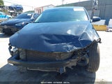HYUNDAI ELANTRA SE 5NPD84LF8HH074685 снимка
