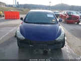 HYUNDAI ELANTRA GLS 5NPDH4AE4DH375765 снимка