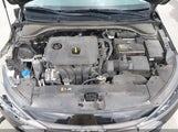 HYUNDAI ELANTRA SEL KMHD84LF3LU008149 снимка