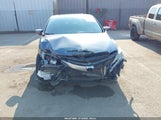 Acura Ilx Special Edition 19UDE2F42JA002404 снимка
