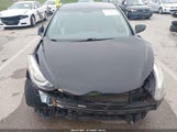 Hyundai Elantra Se 5NPDH4AE9GH686578 снимка