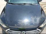 Hyundai Elantra Se KMHD74LF7HU394875 снимка
