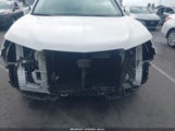Acura Mdx Technology Package Acurawatch Plus Pkg 5J8YD4H58JL024157 снимка
