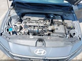 Hyundai Elantra Sel KMHLM4DGXRU658278 fotografie