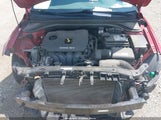 Hyundai Elantra Limited KMHD84LF6HU339606 снимка