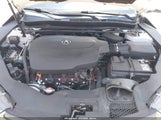 Acura Tlx Tech A-Spec Pkgs 19UUB3F67KA002867 снимка