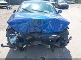 Hyundai Elantra Se 5NPD74LFXHH194314 снимка