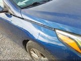 Hyundai Sonata 5NPE24AF2HH531757 снимка