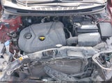 Hyundai Elantra Gls KMHDH4AE3DU556549 снимка