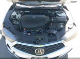 Acura Tlx Tech A-Spec Pkgs 19UUB2F64JA001930 снимка