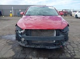 Hyundai Elantra Se 5NPD84LF9HH028377 снимка