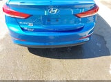 Hyundai Elantra Se 5NPD74LF5JH398542 снимка