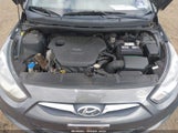 Hyundai Accent Gls KMHCT4AE7CU093520 снимка