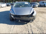 Hyundai Elantra Gls (Ulsan Plant) KMHDH4AE8CU345930 photo
