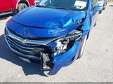 Chevrolet Malibu Fwd 1Lt 1G1ZD5ST8PF241708 fotografie