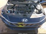 Hyundai Elantra Limited KMHLP4DG8RU822425 снимка