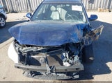 Hyundai Elantra Gls KMHDU4AD2AU886956 снимка