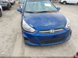 Hyundai Accent Se KMHCT4AE1HU249901 снимка