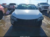 Toyota Camry Se 4T1BF1FKXFU887724 снимка