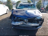Acura Rdx Advance Package 5J8TC2H73LL034486 снимка