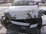 Hyundai Elantra Limited 5NPD84LF2HH078571 снимка