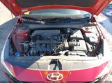 Hyundai Elantra Se KMHLL4AG7PU495934 снимка