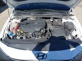 Hyundai Elantra N KMHLW4DK7RU022559 снимка