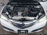 Acura Tlx 19UUB1F30HA008321 снимка