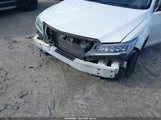 Acura Ilx Premium Package/Technology Plus Package 19UDE2F71HA004973 снимка