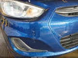 Hyundai Accent Se KMHCT4AEXHU298336 снимка