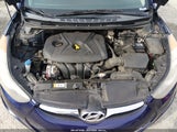 Hyundai Elantra Gls 5NPDH4AE9DH379181 снимка