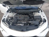 Acura Tlx Technology Package 19UUB5F43MA010557 снимка