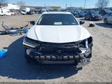 Acura Tlx Technology Package 19UUB5F41PA004311 снимка