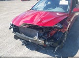 Hyundai Elantra Sel KMHLS4AG0PU581458 снимка