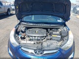 Hyundai Elantra Gls KMHDH4AE0DU755641 снимка