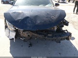 Toyota Camry Se 4T1BF1FKXHU287546 снимка