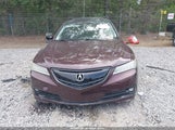 Acura Tlx V6 Advance 19UUB3F71FA004385 снимка