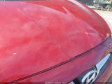 Hyundai Accent Se KMHCT4AE2HU389343 снимка
