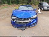 Acura Tlx Technology/A-Spec 19UUB3F6XLA801687 снимка