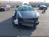 Hyundai Elantra KMHD84LF4HU416067 снимка