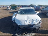 Hyundai Elantra Preferred With Sun And Safety Package Auto Ivt KMHD84LF1LU940821 fotografie
