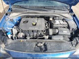 Hyundai Elantra Se 5NPD74LF6HH073523 снимка